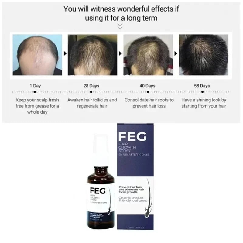FEG Hair Growth Spray 1 Fl Oz Anti-Dandruff & Frizz Control