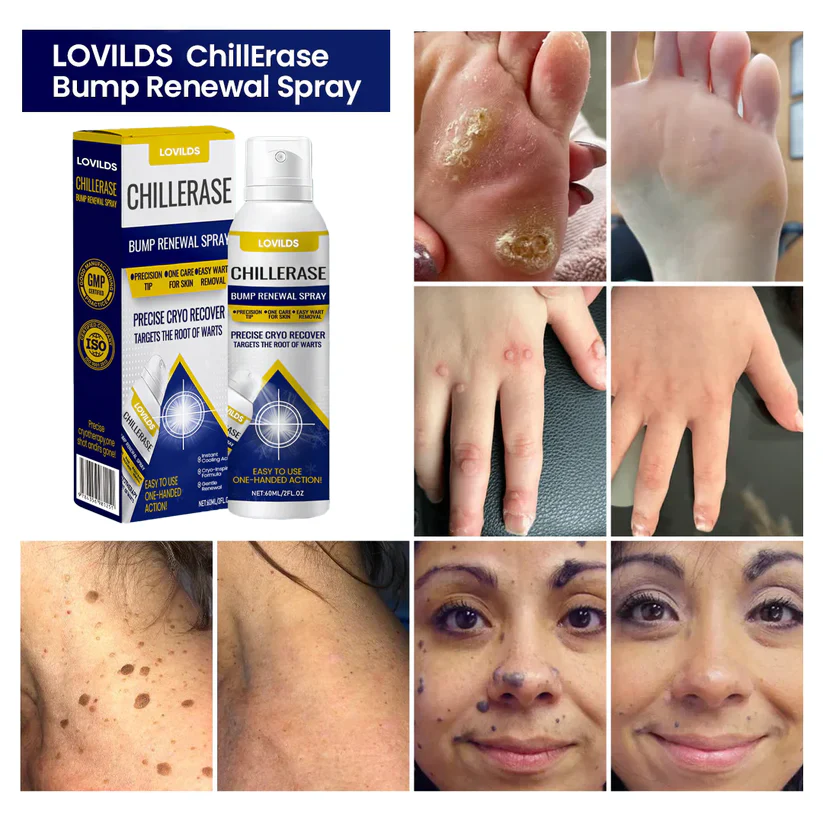 Timilk® ChillErase Bump Renewal Spray