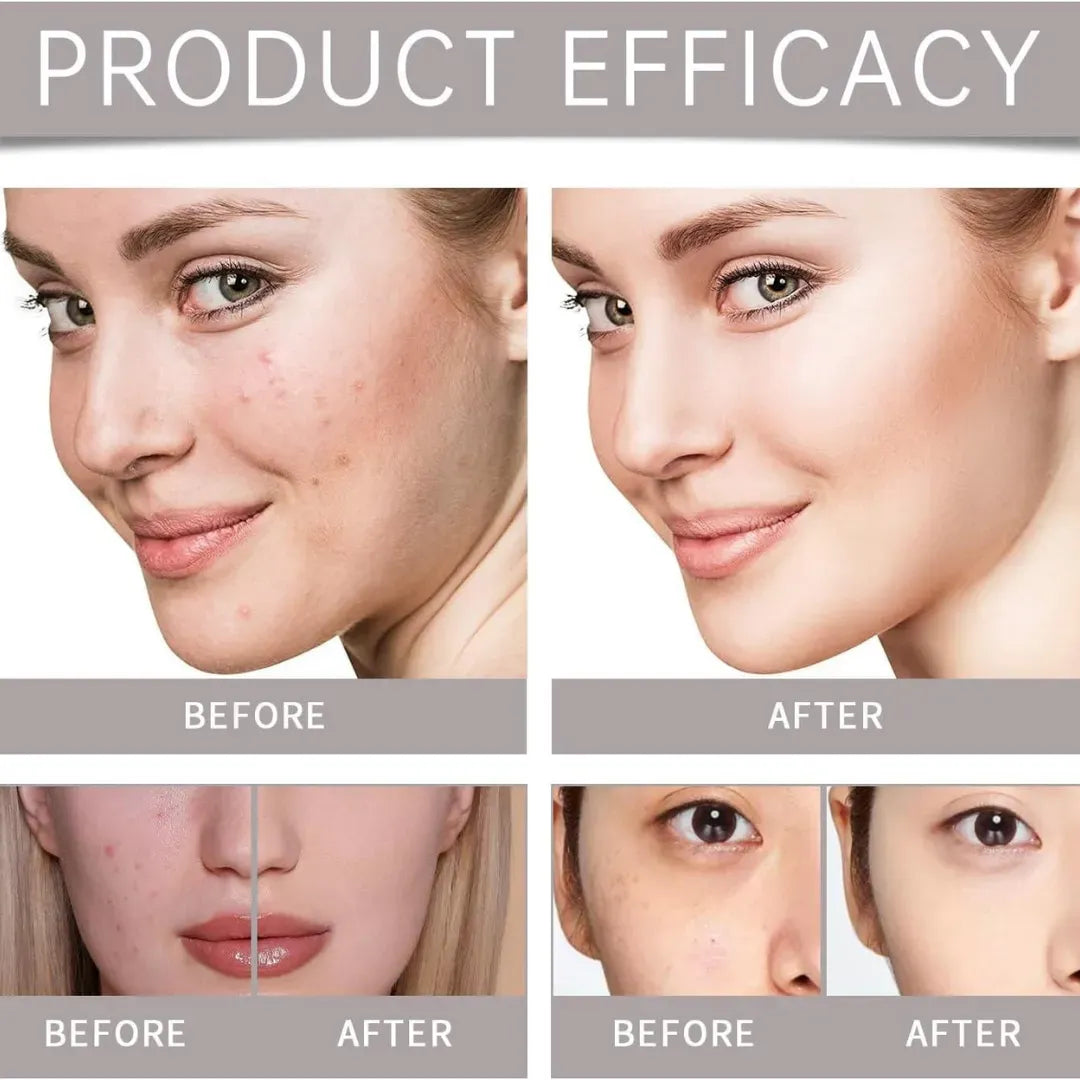 Teashell Niacinamide Brightening Serum | Fade Dark Spots, Acne Marks & Even Skin Tone | Teashell serum
