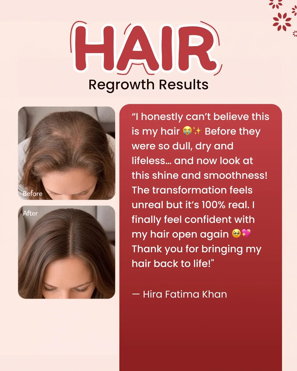 Roots Hair Treatment Serum