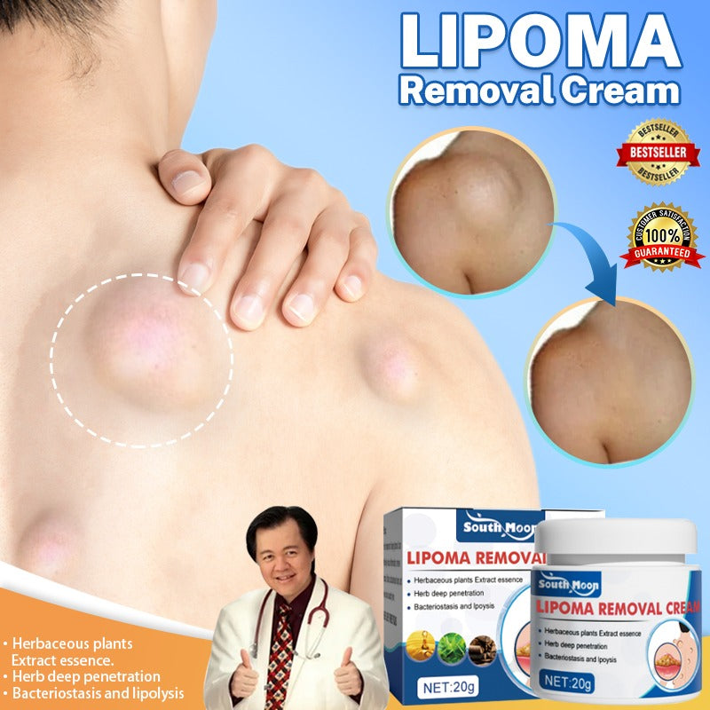 Lipo-PRO Lipoma Removal Cream | External Care for Skin Lumps