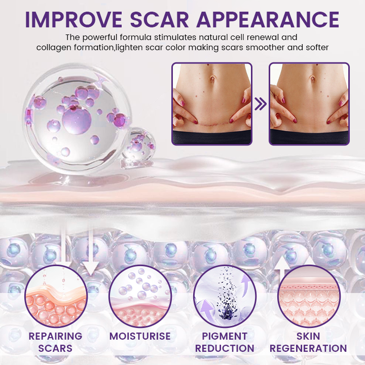 Timilk® ReGenScar Stem Cell Scar Gel – Advanced Skin Repair Formula for Acne, Stretch Marks & Surgical Scars | Fast Healing & Smooth Skin Care
