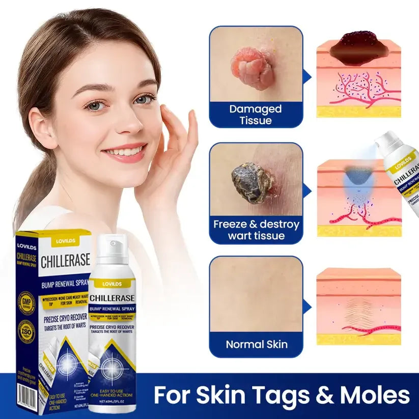 Timilk® ChillErase Bump Renewal Spray