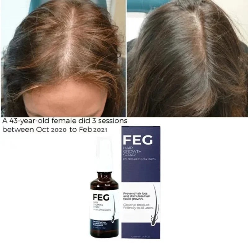 FEG Hair Growth Spray 1 Fl Oz Anti-Dandruff & Frizz Control