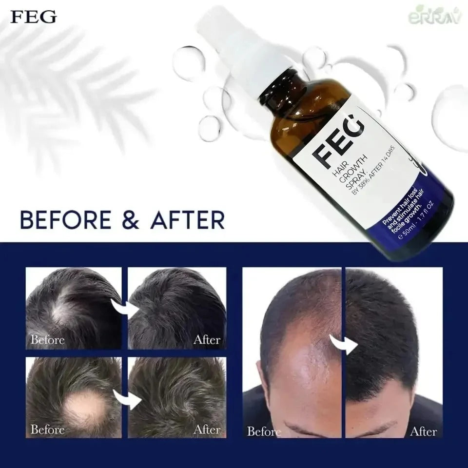 FEG Hair Growth Spray 1 Fl Oz Anti-Dandruff & Frizz Control